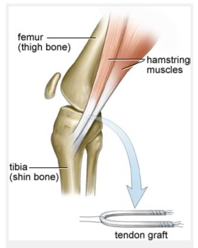 Biceps femoris Caput breve